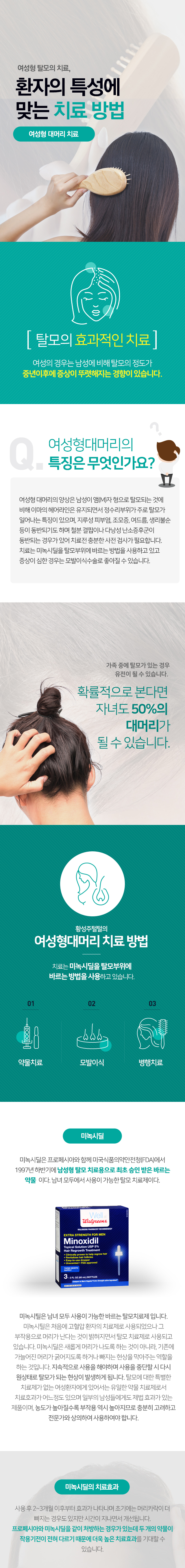 여성형 대머리 치료